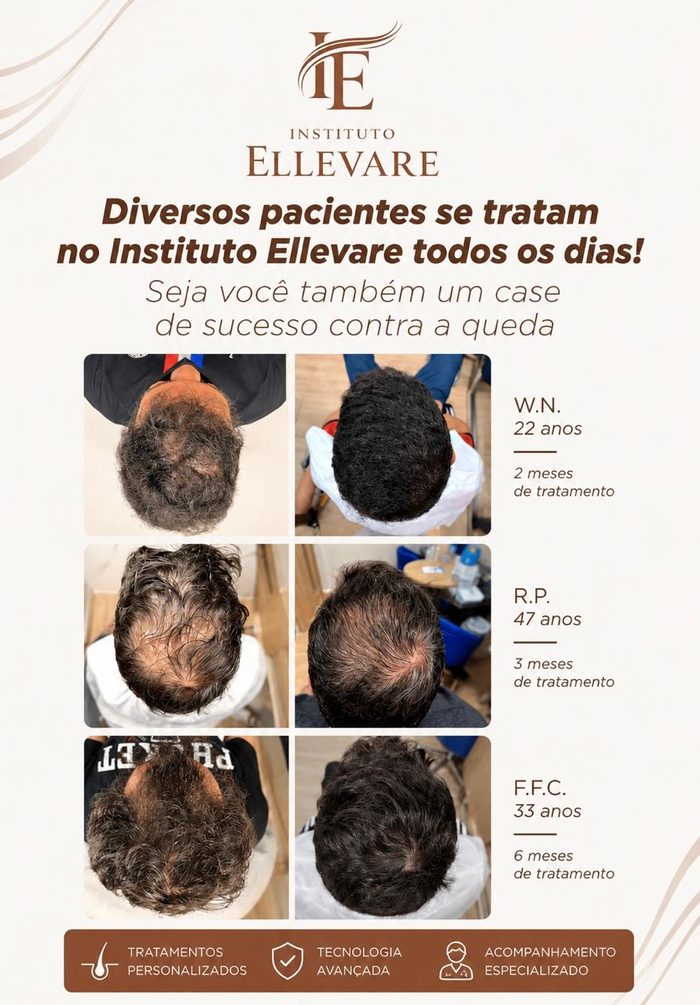 Resultados de pacientes tratados no Instituto Ellevare